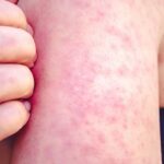 WhatsApp Image 2026-02-11 at 9.39.32 AM