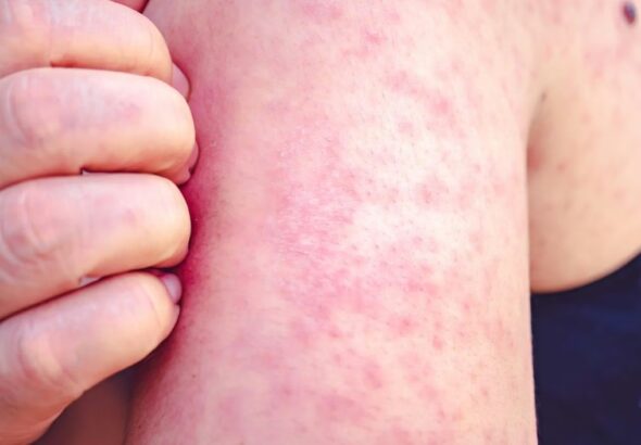 WhatsApp Image 2026-02-11 at 9.39.32 AM